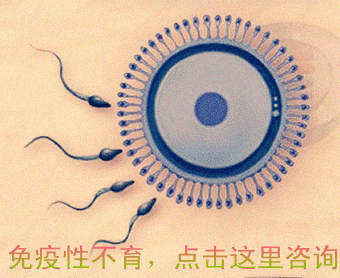 免疫性不育
