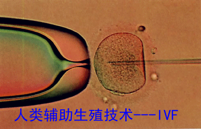 IVF