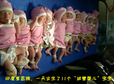 试管婴儿