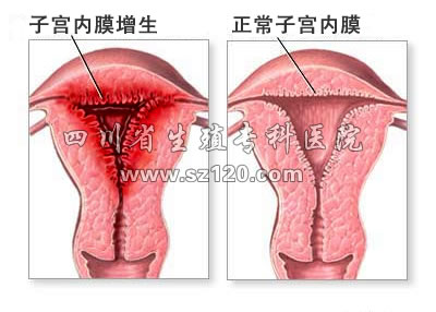 正常子宫内膜的表现
