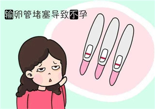 输卵管堵塞导致女性不育
