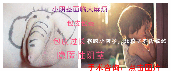 [杭州日报] 家长留意:肥胖儿童易患隐匿性阴茎